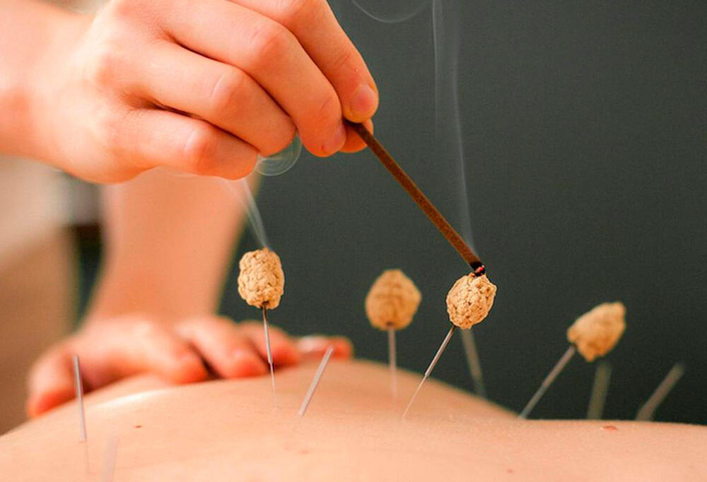 Традиционная медицина - культурное наследие Китая