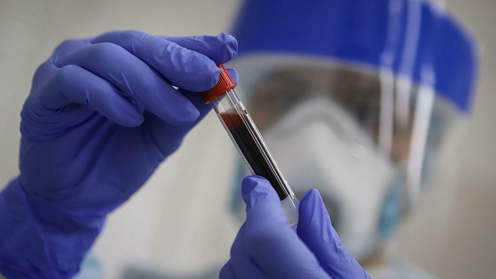 ҚР 1 қарашаға арналған эпидемиологиялық жағдай: бір тәулік ішінде коронавирус ауруының 1 395 жаңа жағдайы