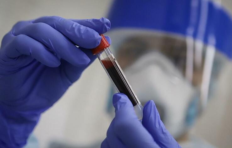 Сводка эпидситуации в РК: за сутки зарегистрировано 1328 новых случаев коронавируса