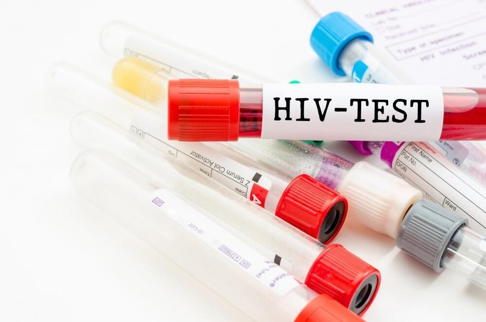 Проверку на ВИЧ придется пройти некоторым казахстанцам в РФ