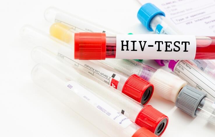 Проверку на ВИЧ придется пройти некоторым казахстанцам в РФ