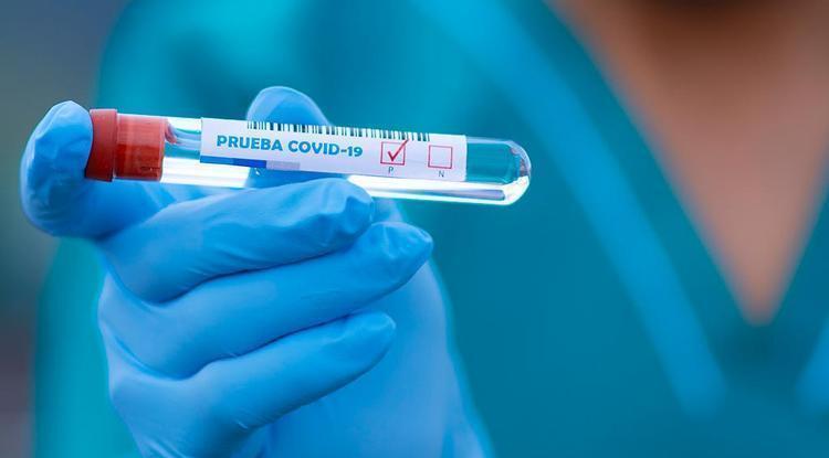 Сводка эпидситуации в РК: за сутки зарегистрировано 753 новых случая коронавируса