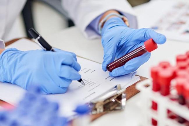 ҚР 3 желтоқсанға арналған эпидемиологиялық жағдай: бір тәулік ішінде COVID-19 ауруының 724 жаңа жағдайы анықталды