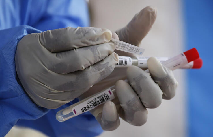 Сводка эпидситуации в РК: от коронавируса за сутки скончались 20 человек