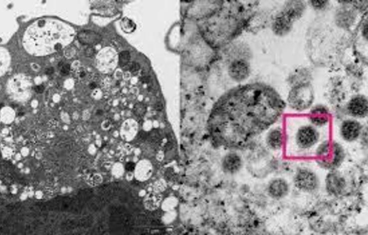 Health Ministry informed whether omicron-strain of coronavirus entered Kazakhstan