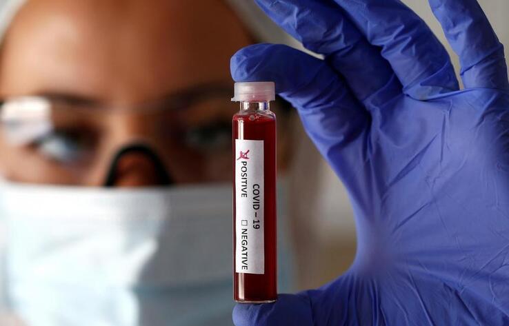 ҚР 21 желтоқсанға арналған эпидемиологиялық жағдай: бір тәулікте коронавирустың 369 жаңа жағдайы тіркелді