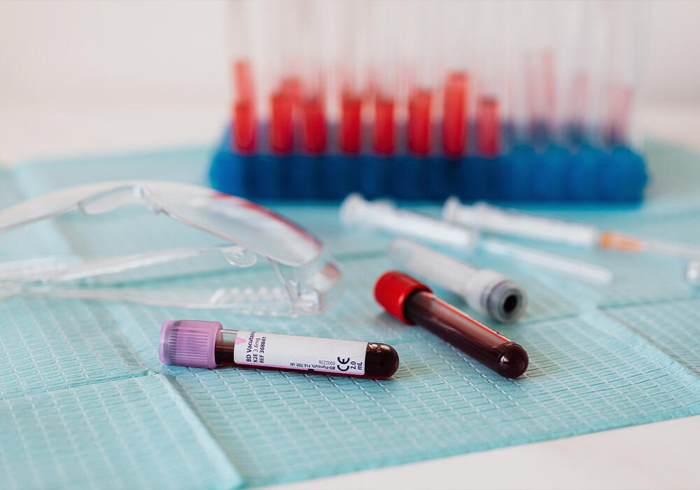 В РК лаборатории могут проводить диагностику ВИЧ без дополнительной лицензии