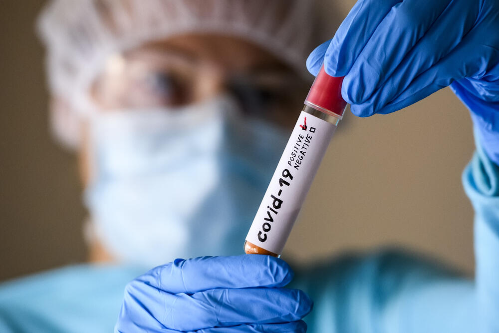 Сводка эпидситуации в РК: за сутки выявлено 13 652 новых случая заболевания коронавирусом