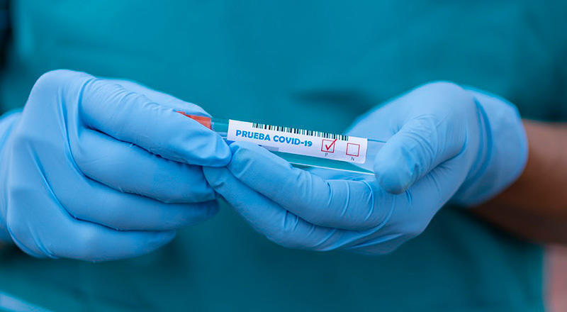 ҚР 1 ақпанға арналған эпидемиологиялық жағдай: бір тәулікте 5 466 жаңа коронавирус ауруы
