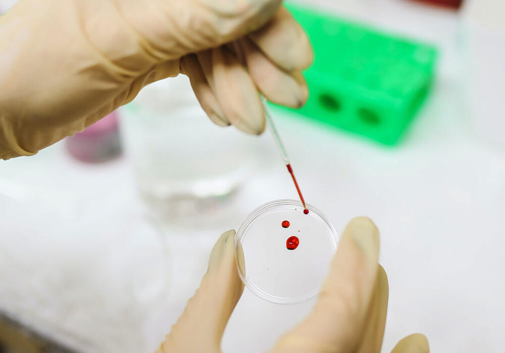 Диагноз конго-крымской лихорадки подтвердился в Шымкенте