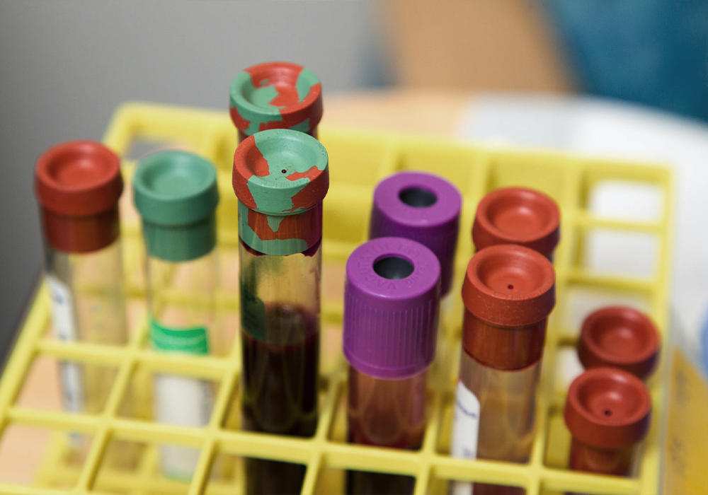 Қазақстанда өткен тәулікте COVID-19-дың 158 жаңа жағдайы тіркелді