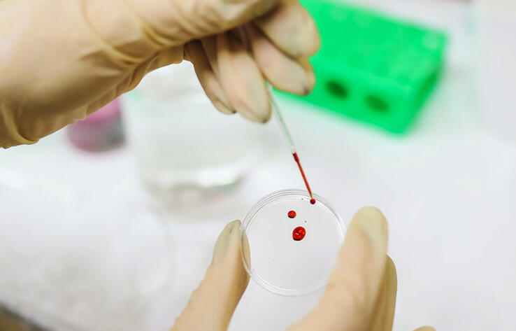 На 19% выросли показатели распространенности ВИЧ в двух областях Казахстана 