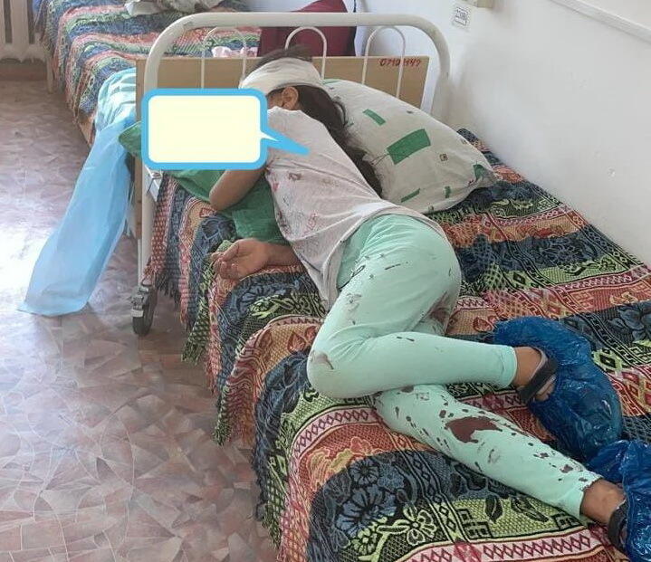 Автомобиль закидали камнями на Алаколе, пострадал ребенок