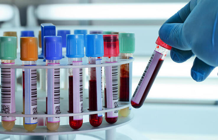 Қазақстанда бір тәулікте коронавирус ауруының 478 жаңа жағдайы тіркелді