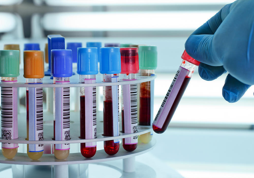 Қазақстанда бір тәулікте коронавирус ауруының 197 жағдайы тіркелді