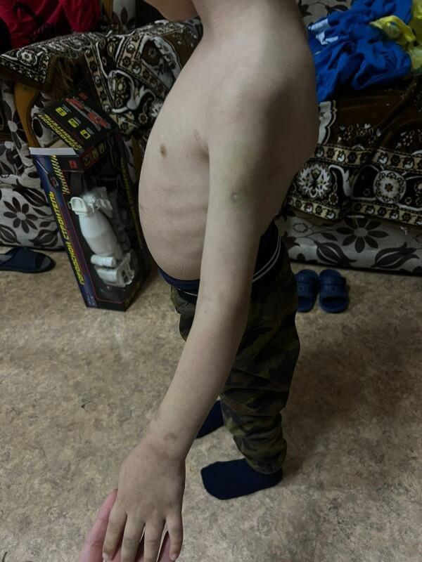 Пятилетнего мальчика истязали в Акмолинской области. Фото: 716.kz