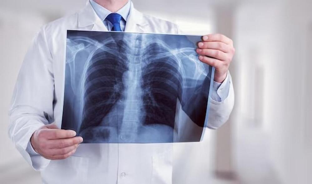 Қазақстанда туберкулезбен сырқаттанушылық көрсеткіші төмендеді 