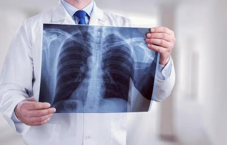 Қазақстанда туберкулезбен сырқаттанушылық көрсеткіші төмендеді 