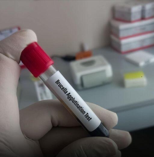 Заболеваемость бруцеллезом среди людей выросла более чем на 40% в области Жетісу