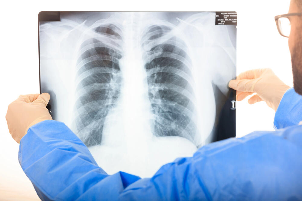 Проверку провели в школе Костанайской области после выявления случая туберкулеза